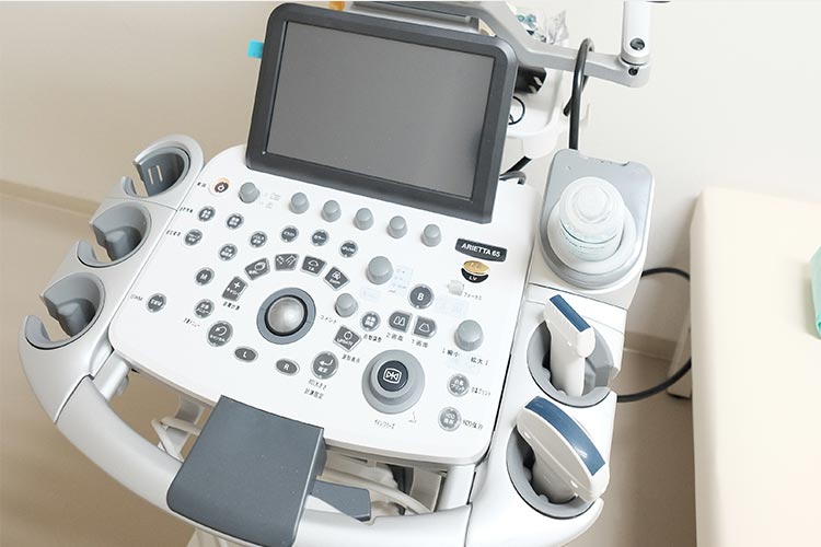 超音波診断装置